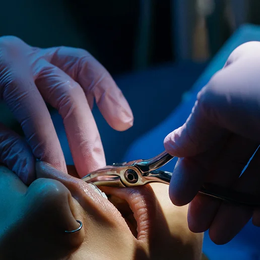 68d1c5e6c8b09bbc4ef6bf31_surgery